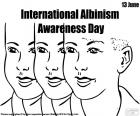 Albinism Διεθνής Ημέρα ευαισθητοποίησης